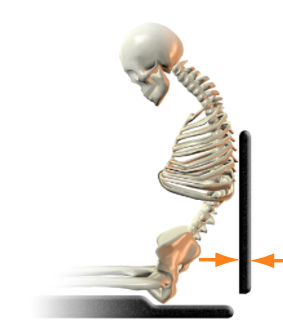 Posterior sacral support not present