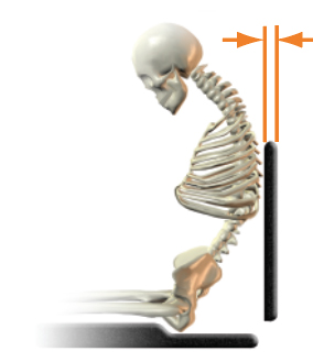 Posterior thoracic support (shape) - too little