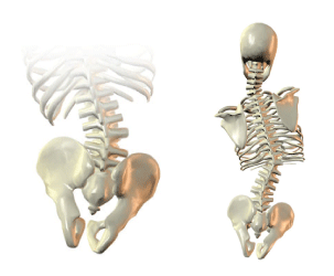 JAY Cushions: Pelvic Obliquity Management